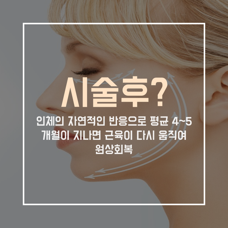 강릉 피부과 얼굴 축소 효과 보톡스로